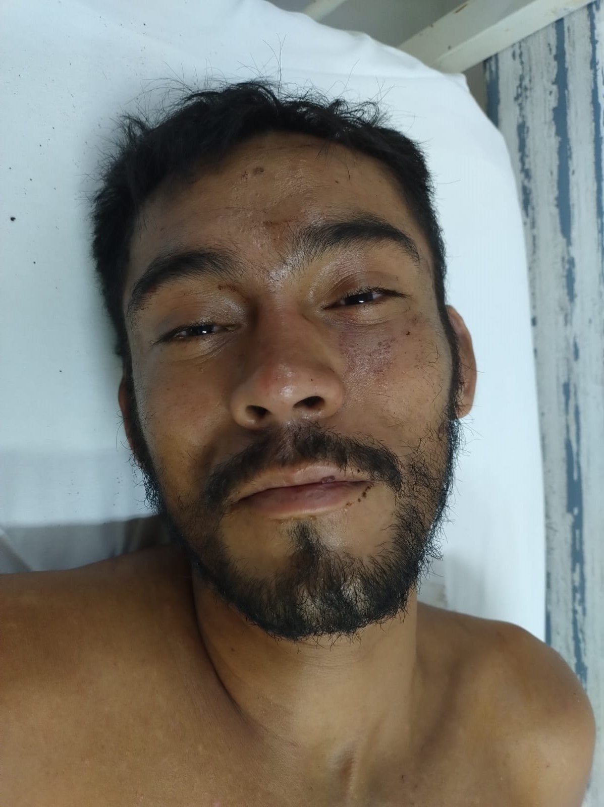 Hospital procura família de homem internado após ser espancado em Manaus