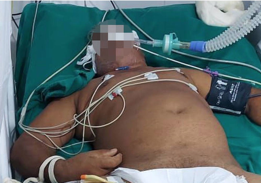 Nas UTIs de Covid, prática se espalha e pacientes são amarrados às camas 