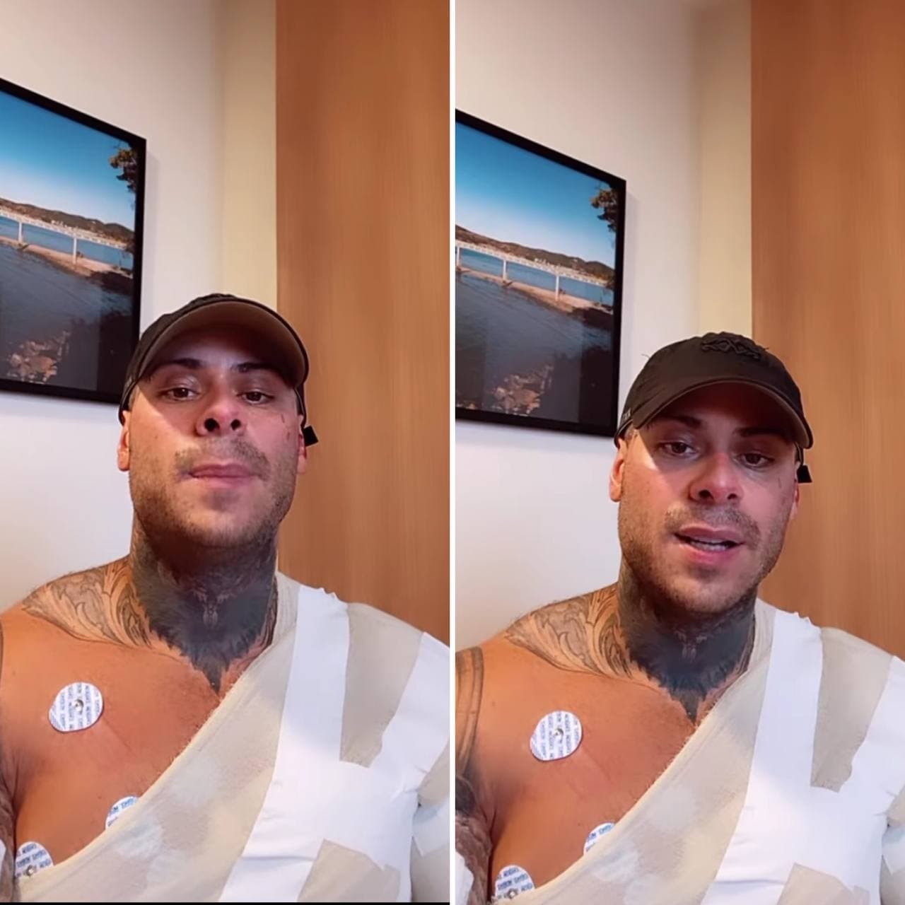 Leo Stronda tem corpo queimado após explosão de botijão de gás