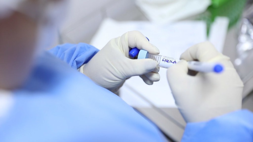 Amazonas registra 412 novos casos e 5 mortes por Covid-19