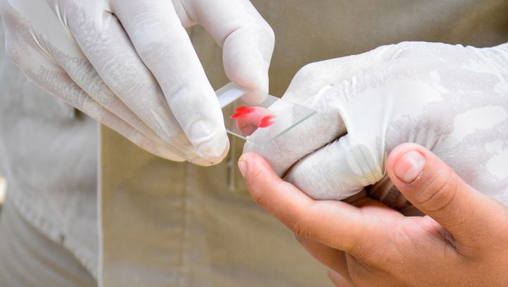 Nova medicação no tratamento de malária será implementada em Manaus