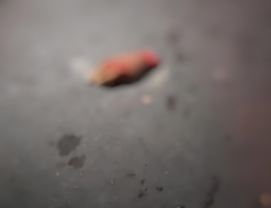 Homem tem a mão decepada após levar terçadada de criminoso em Manaus