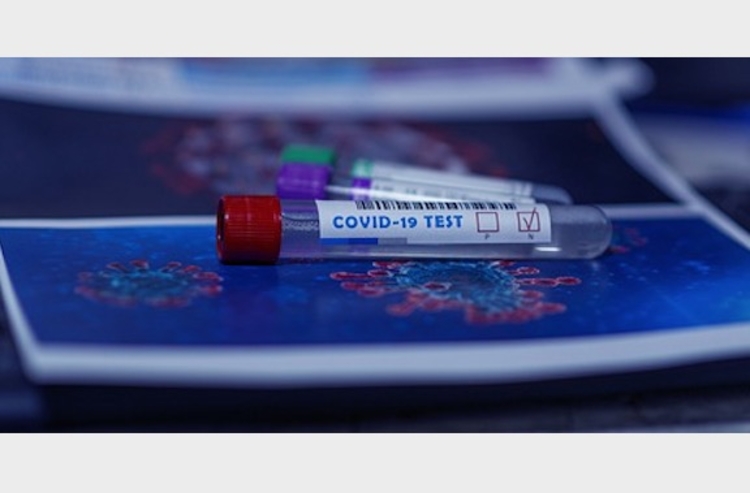 Pelo menos 40 atletas testaram positivo para covid nas Olimpíadas