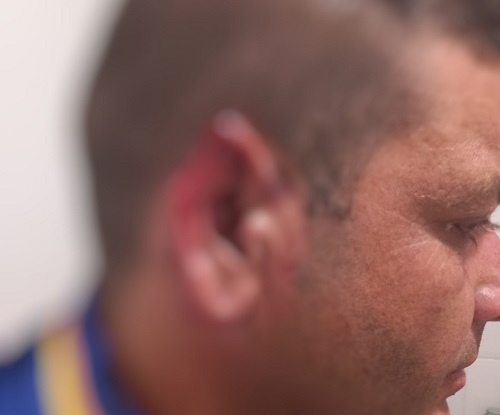 Frentista tem pedaço da orelha arrancada durante briga em posto