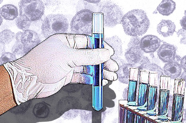 Vacina contra HIV, da Johnson & Johnson, se mostra ineficiente contra o vírus