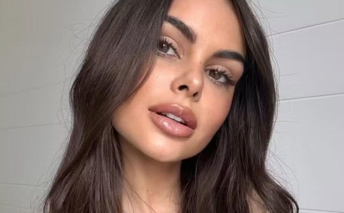 Amanda Kimberlly, mãe da filha de Neymar, remove harmonização facial: 'rostinho que não me pertence'