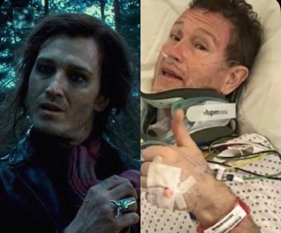 Astro de Harry Potter pode perder capacidade de andar e falar após cirurgia