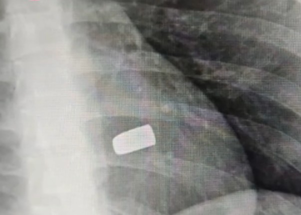 Jovem morre ao ser crivado de tiros no meio da rua em Manacapuru