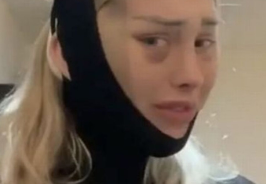 Cabeça de mulher 'explode' durante voo e motivo do acidente é revelado