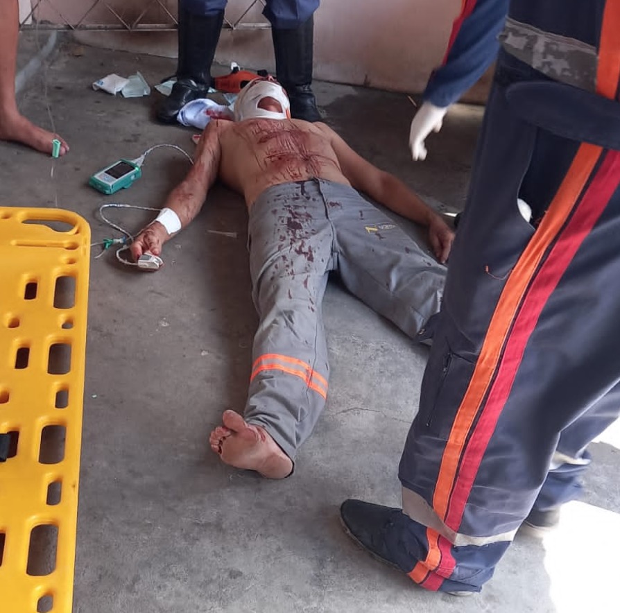 Eletricista da Amazonas Energia é baleado durante assalto no Petrópolis