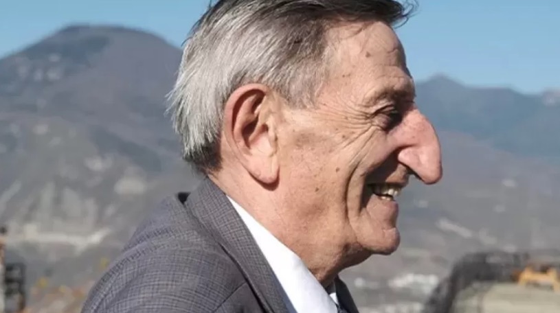 Conheça o homem com o maior nariz do mundo