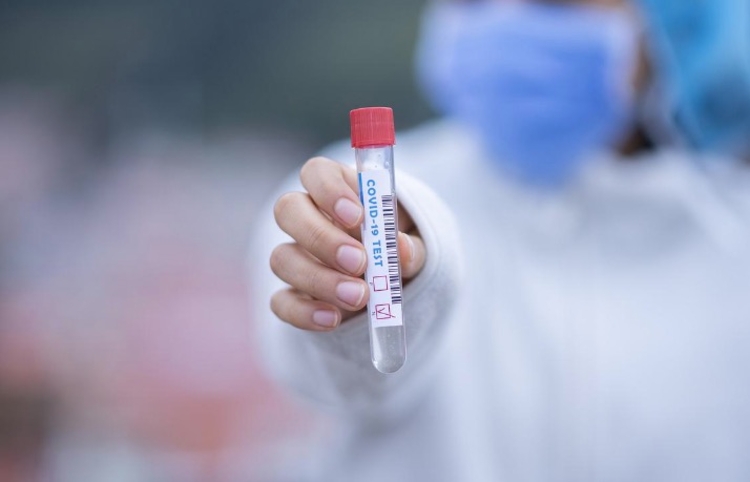 Covid-19: Brasil acumula 30,5 milhões de casos e 663,7 mil óbitos