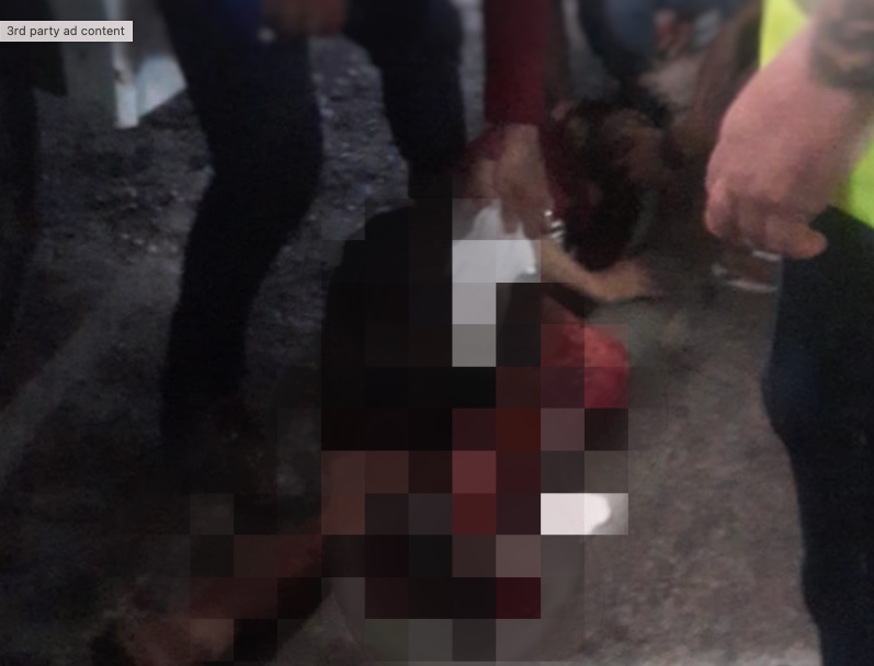 Homem tem perna esmagada por ônibus durante acidente em terminal de Manaus