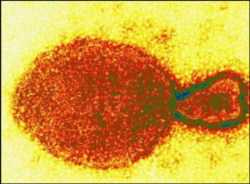 Henipavirus: Veja tudo o que se sabe sobre o novo vírus identificado na China