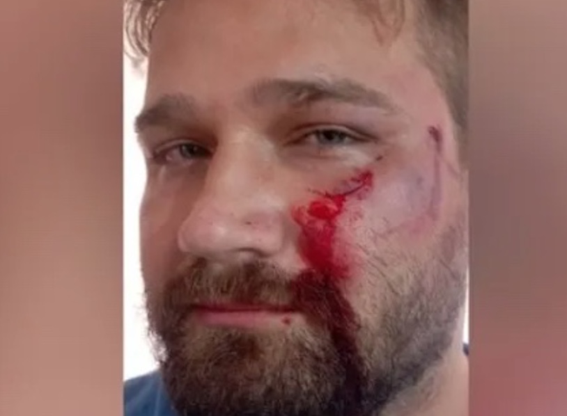 Médico é agredido com golpes de capacete após negar atestado para paciente