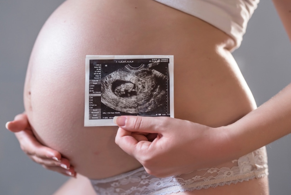 Ministro do STJ nega habeas corpus para mulher realizar aborto de gêmeos siameses