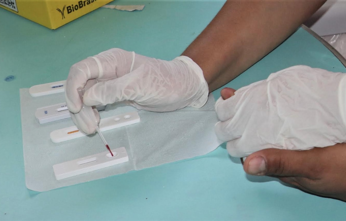 Amazonas contabiliza 4,6 mil casos de Sífilis e FVS oferta testagem rápida em Manaus