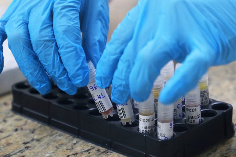 Amazonas ultrapassa 300 casos de varíola dos macacos nesta quarta-feira