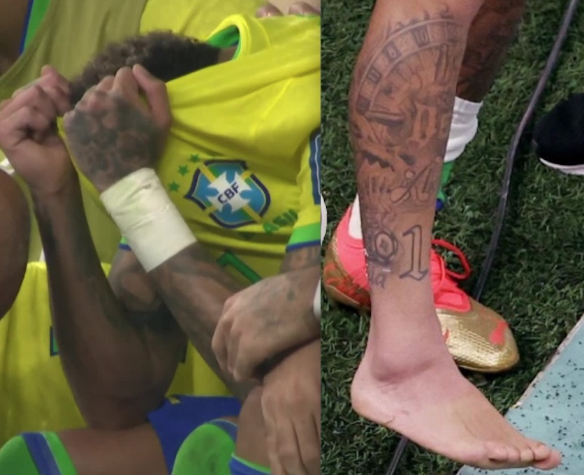 Veja como ficou o tornozelo de Neymar e o momento da contusão