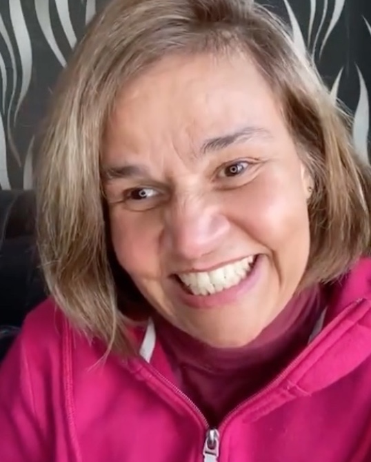 Claudia Rodrigues fará cirurgia milionária para tratar sequelas da esclerose múltipla 