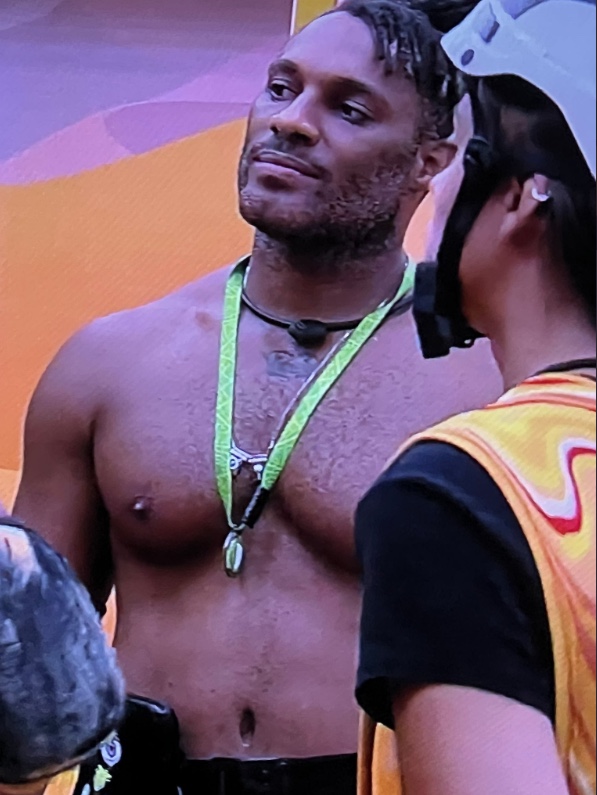 Adm de Fred Nicácio desmente cirurgia plástica e explica cicatrizes: '8 cirurgias e foi entubado'