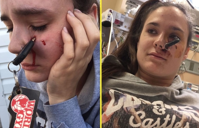 Chave fica cravada no rosto de motorista após ser arremessada por amiga