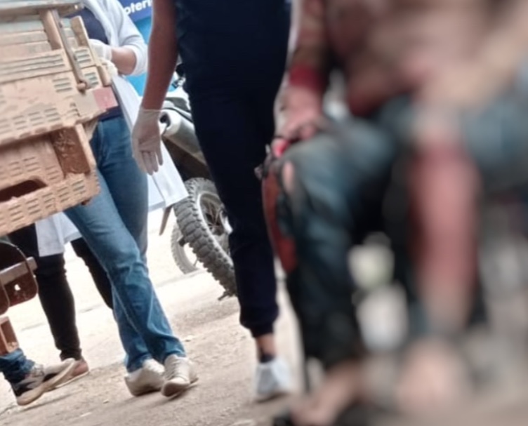 Avião cai no Amazonas e piloto tem corpo tomado por chamas