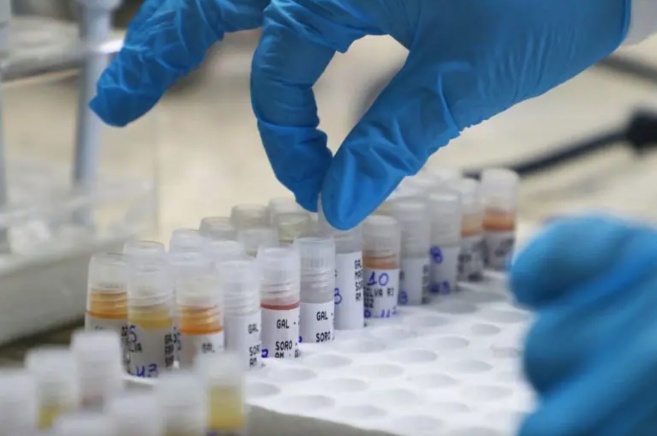 Amazonas chega a 2 meses sem confirmar novos casos de Mpox