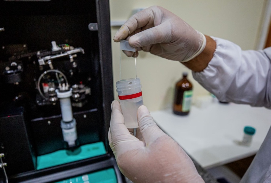 Manaus inicia exame preventivo com maior eficácia no diagnóstico até fim de maio