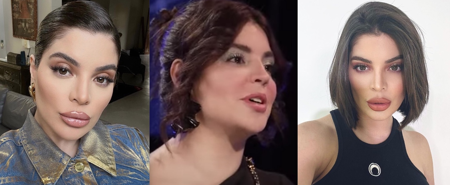 Gkay conta que retirou 3 litros de ácido hialurônico do rosto e explica decisão