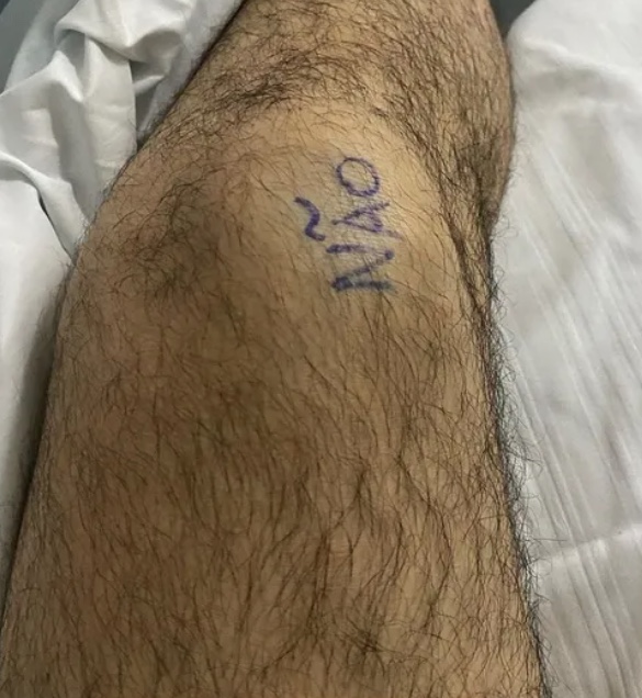 Paciente escreve ‘sim’ e ‘não’ nos joelhos para evitar erro em cirurgia 