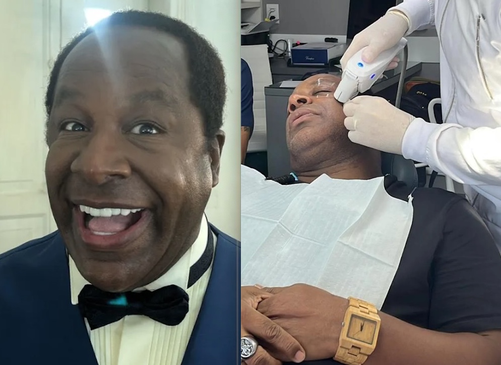 Aílton Graça fez procedimento com o próprio sangue para interpretar Mussum