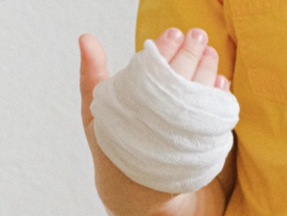 Pai e madrasta são indiciados após criança ter corpo queimado com colher quente em Manaus