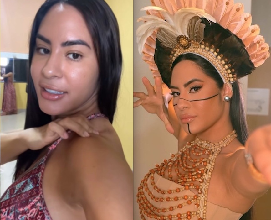 Isabelle mostra marcas causadas por indumentária do Festival de Parintins