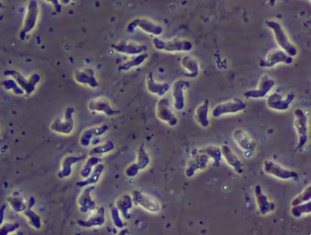 Morte de bebê é investigada após suspeita de infecção por ameba super-rara no Brasil