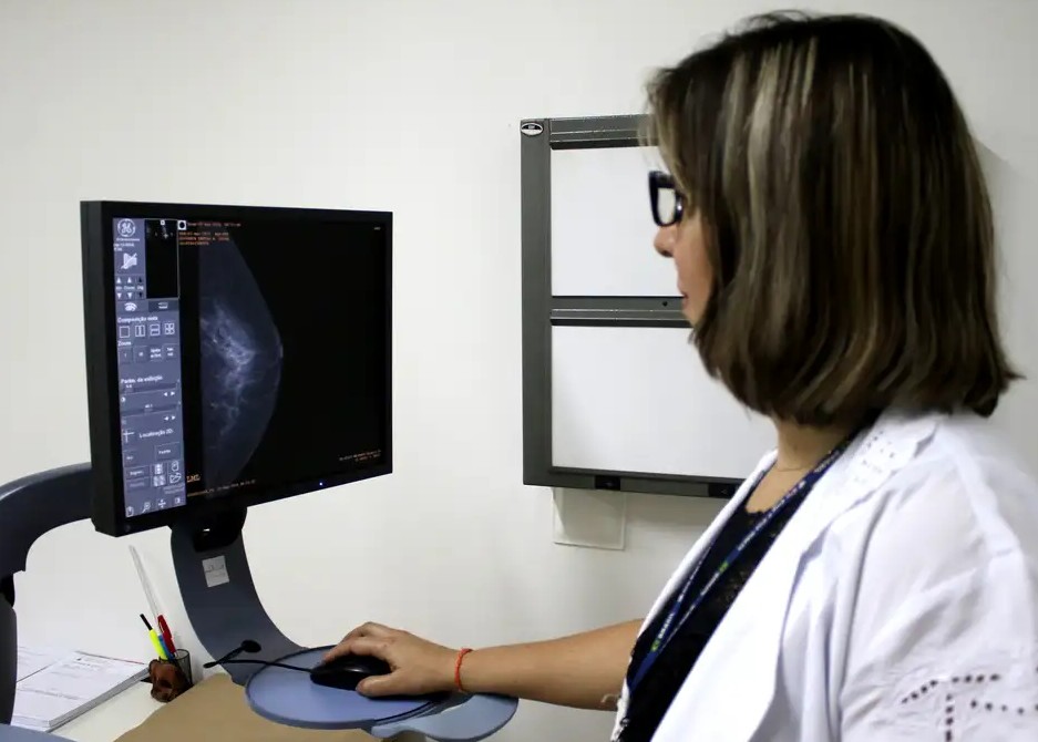 Médicos pedem ampliação da faixa etária para mamografia de rastreio do câncer