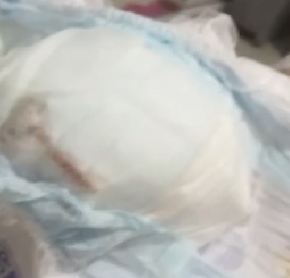 Rato é encontrado morto dentro de fralda de bebê