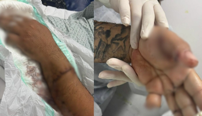 Passageiro ataca motorista de app com terçado e pitbull em Manaus