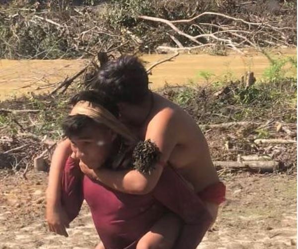 Indígena carrega irmã grávida por 2 horas após jovem levar picada de cobra