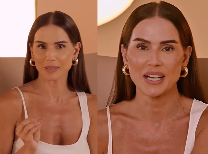 Déborah Secco faz procedimentos para rejuvenescer rosto e abdômen: 'a pele esticou muito'