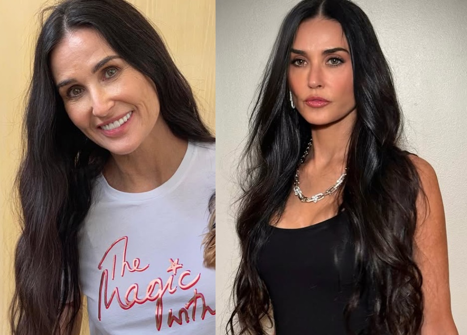 Face Lifting? Demi Moore impressiona com rosto rejuvenescido aos 62 anos; veja antes e depois