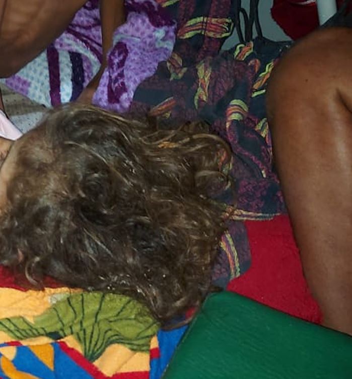 Irmãos achados em mata são transferidos em UTI aérea para Manaus; estado deles é delicado