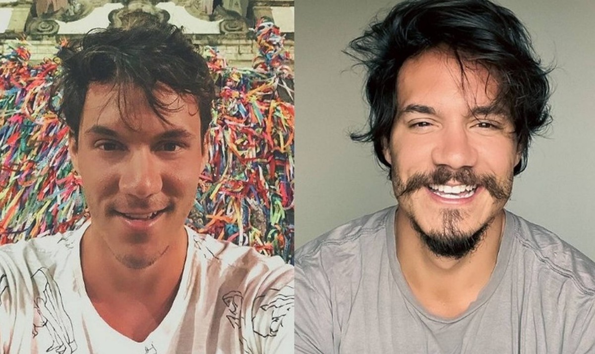 No BBB 22, Eliezer revela que parcelou harmonização em 24 vezes; Veja antes e depois