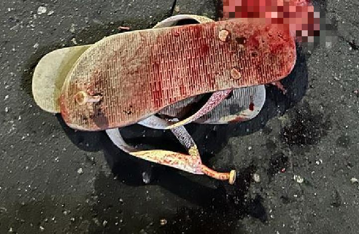 Adolescente vai parar no hospital ao ter cabeça crivada de tiros em Manaus 