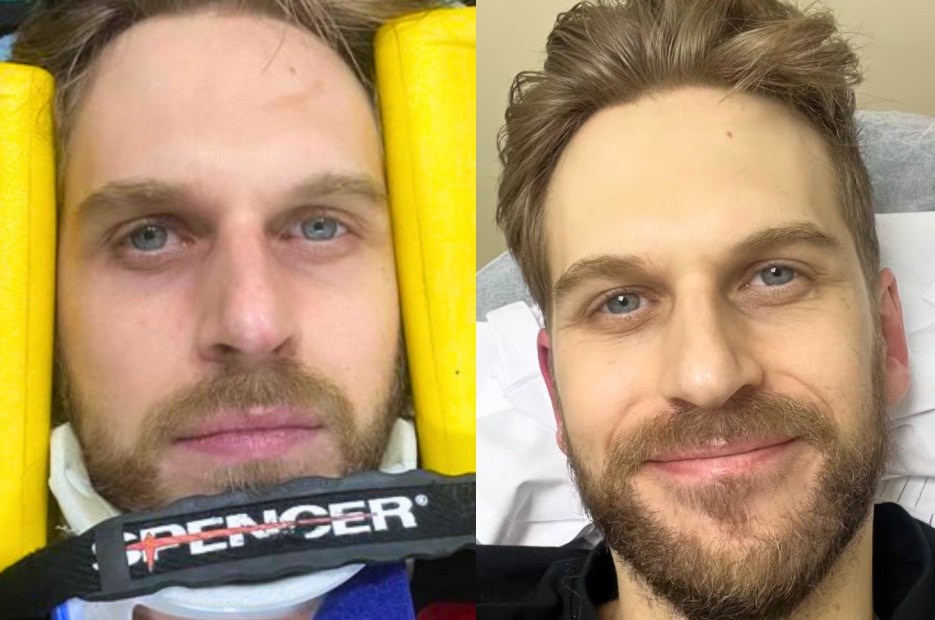 Humorista francês Paul Cabannes manda mensagem para filha após grave acidente