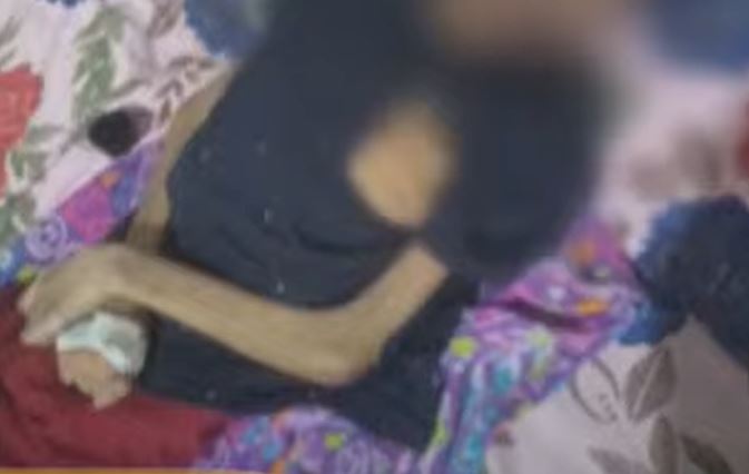 Adolescente deficiente que era vítima de maus-tratos em Manaus está na UTI