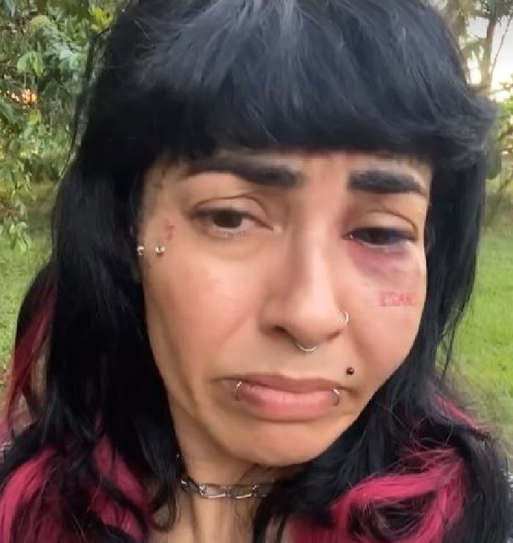 Lutador de jiu-jitsu é suspeito de agredir namorada em Manaus 