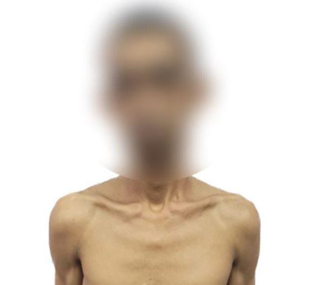 Mototaxista que estuprou adolescente fez mais duas vítimas no Amazonas 