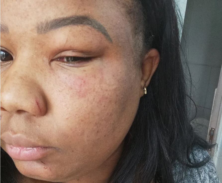 Motorista de app é espancada por passageiros após ouvir música gospel durante corrida