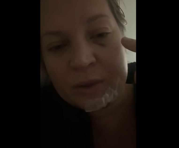 Deputada Joice Hasselmann aparece em vídeo com fraturas no rosto e dentes quebrados